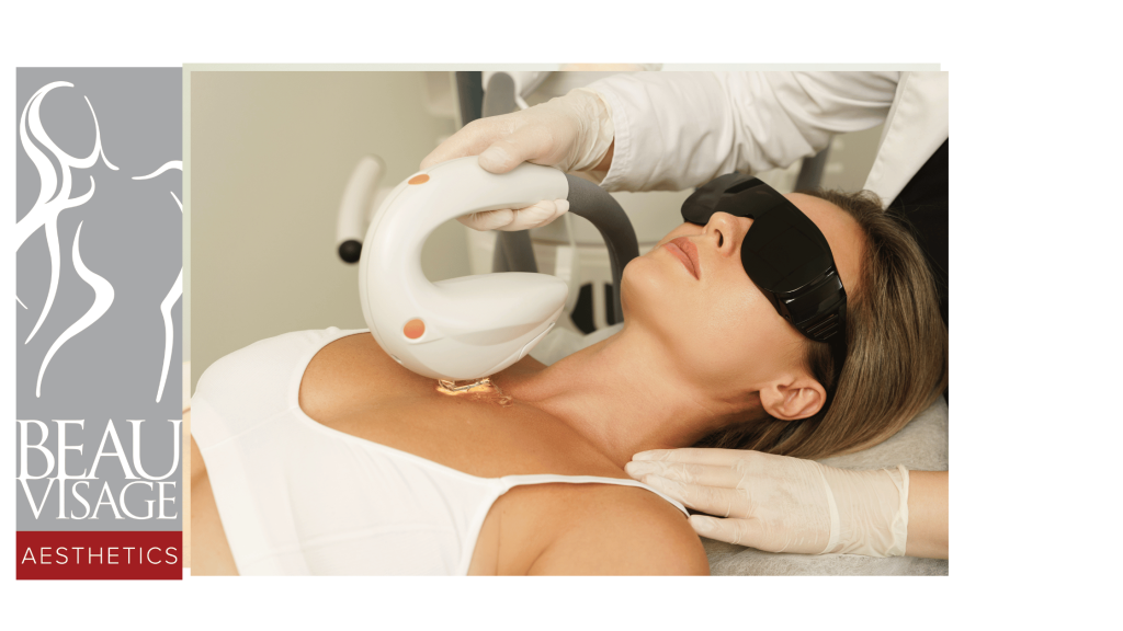 A patient undergoing Intense Pulsed Light (IPL) treatment in a clinical setting. The patient is lying comfortably, with protective goggles on, while a practitioner uses a handheld IPL device on the patient's chest. The treatment area appears to be the patient's chest, and the practitioner is focused on adjusting the device. The room is well-lit, and medical equipment is visible .